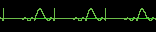 This is not a signal - it's a picture of a signal.  If you don't see the picture, right-click and select *show picture*.